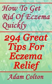how to treat eczema lotion